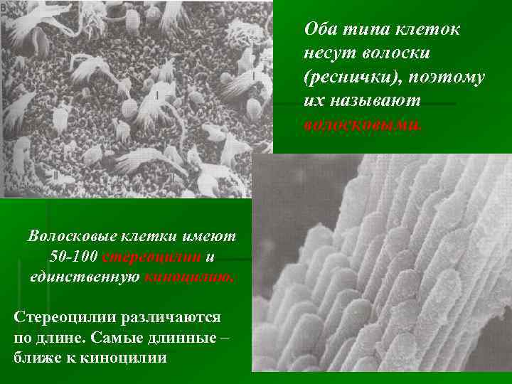 Оба типа клеток несут волоски (реснички), поэтому их называют волосковыми. Волосковые клетки имеют 50