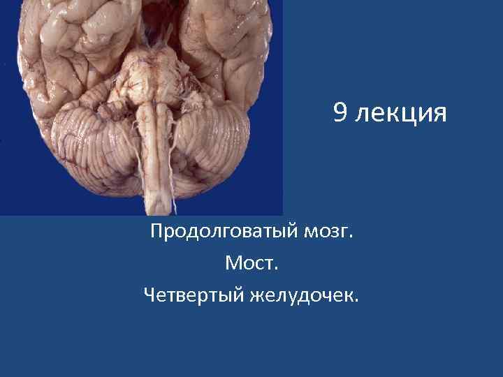 9 лекция Продолговатый мозг. Мост. Четвертый желудочек. 