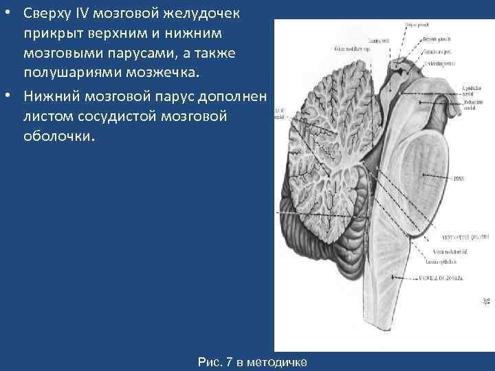  • Сверху IV мозговой желудочек прикрыт верхним и нижним мозговыми парусами, а также