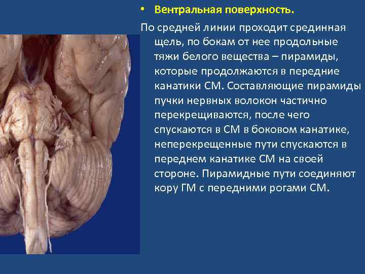  • Вентральная поверхность. По средней линии проходит срединная щель, по бокам от нее