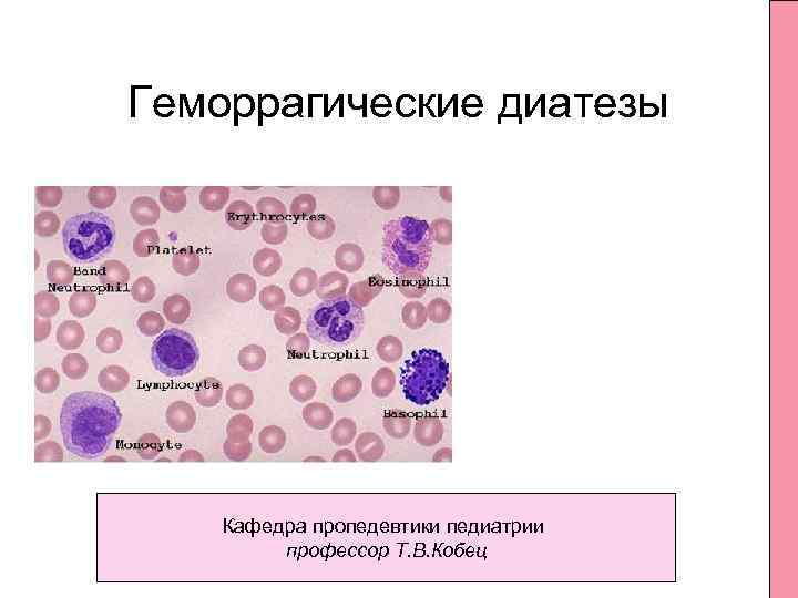 Геморрагические диатезы педиатрия презентация