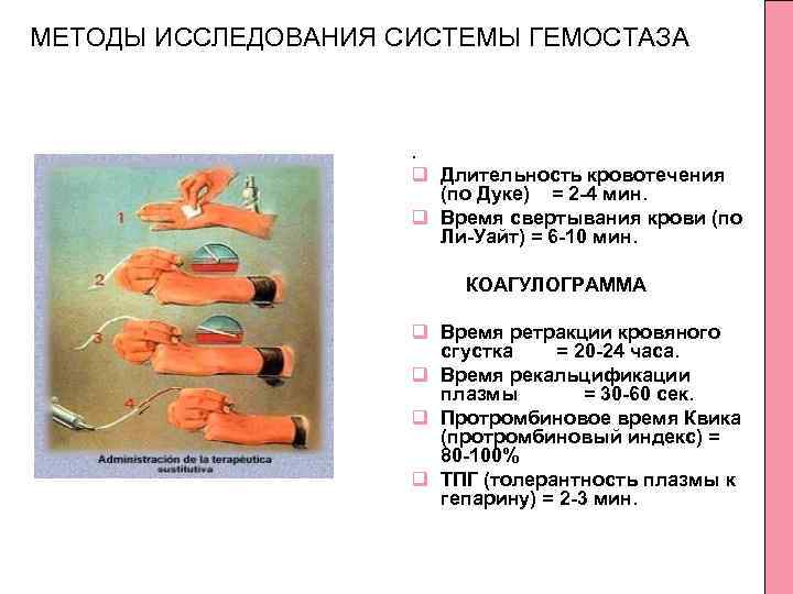 Длительность кровотечения. Длительность кровотечения по Дюке. Методика кровотечения по Дюку. Длительность кровотечения по Дуке норма. Длительность кровотечения крови по Дюке в норме составляет.