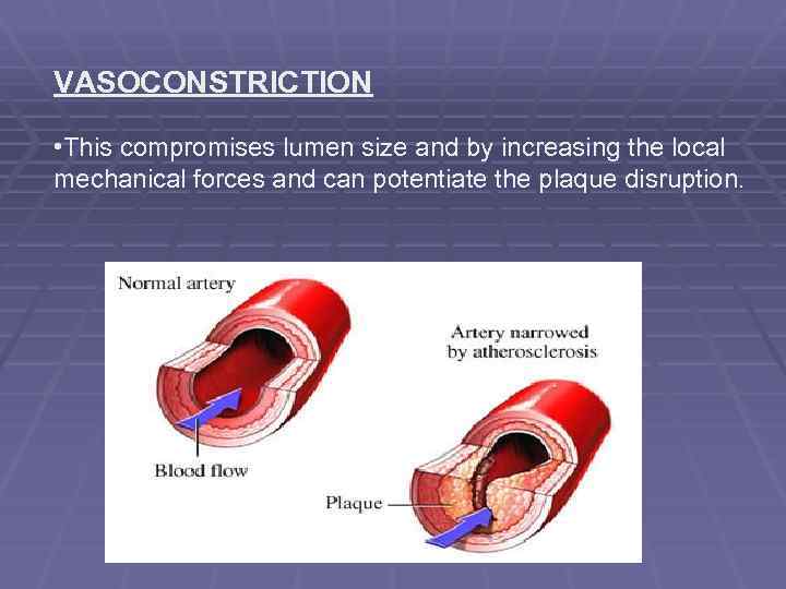 VASOCONSTRICTION • This compromises lumen size and by increasing the local mechanical forces and