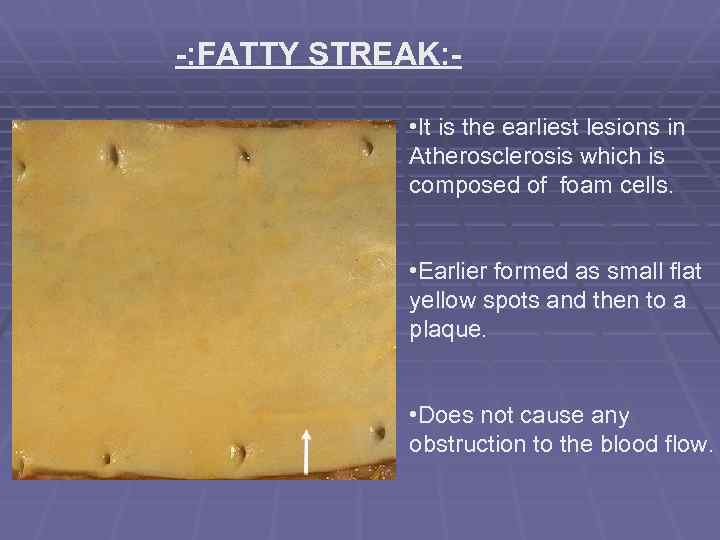 -: FATTY STREAK: • It is the earliest lesions in Atherosclerosis which is composed