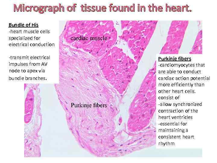 Micrograph of tissue found in the heart. Bundle of His -heart muscle cells specialized