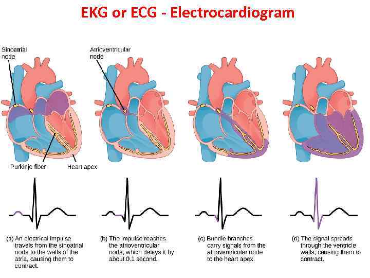 EKG or ECG - Electrocardiogram 