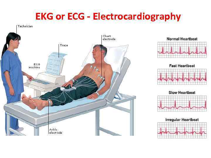 EKG or ECG - Electrocardiography 