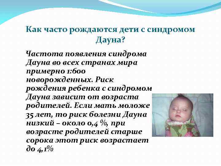 Как часто рождаются дети с синдромом Дауна? Частота появления синдрома Дауна во всех странах