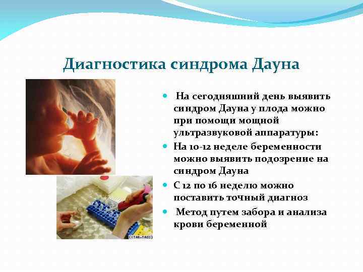 Диагностика синдрома Дауна На сегодняшний день выявить синдром Дауна у плода можно при помощи