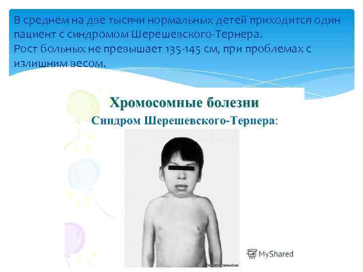 В среднем на две тысячи нормальных детей приходится один пациент с синдромом Шерешевского-Тернера. Рост
