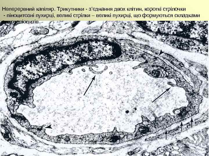 Неперервний капіляр. Трикутники - з’єднання двох клітин, короткі стрілочки - піноцитозні пухирці, великі стрілки