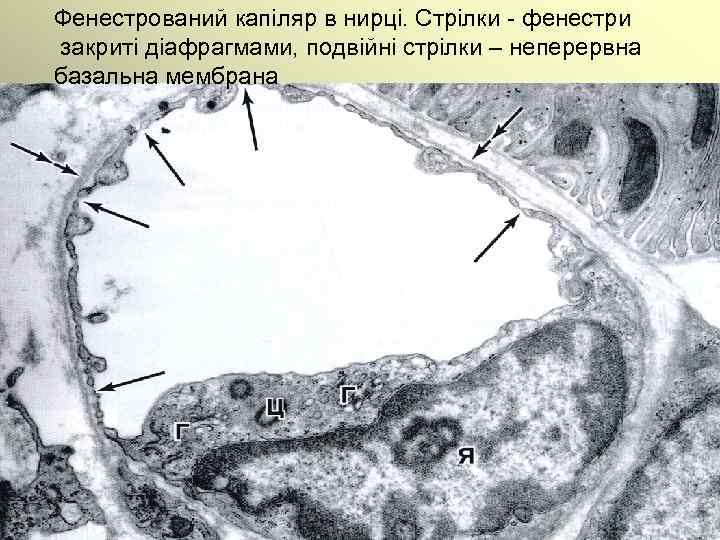 Фенестрований капіляр в нирці. Стрілки - фенестри закриті діафрагмами, подвійні стрілки – неперервна базальна