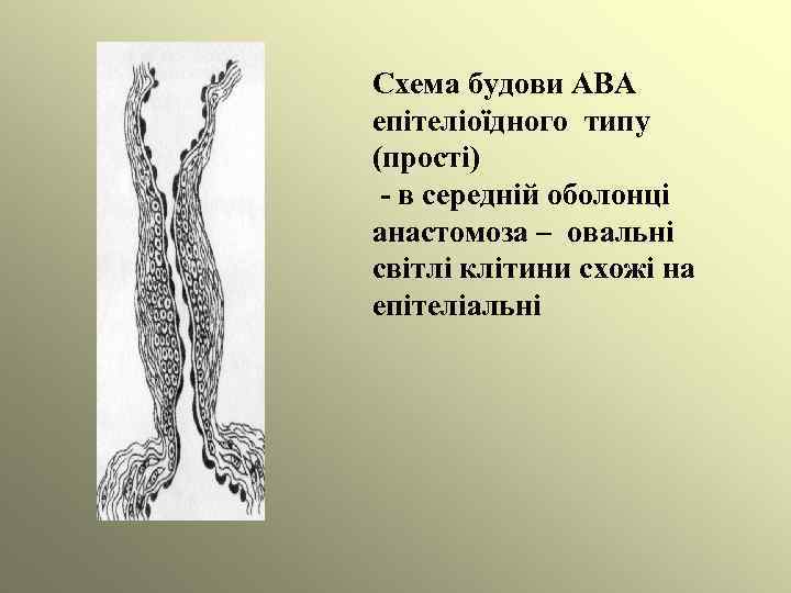 Схема будови АВА епітеліоїдного типу (прості) - в середній оболонці анастомоза – овальні світлі