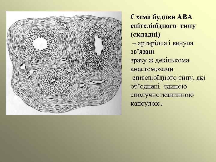 Схема будови АВА епітеліоїдного типу (складні) – артеріола і венула зв’язані зразу ж декількома