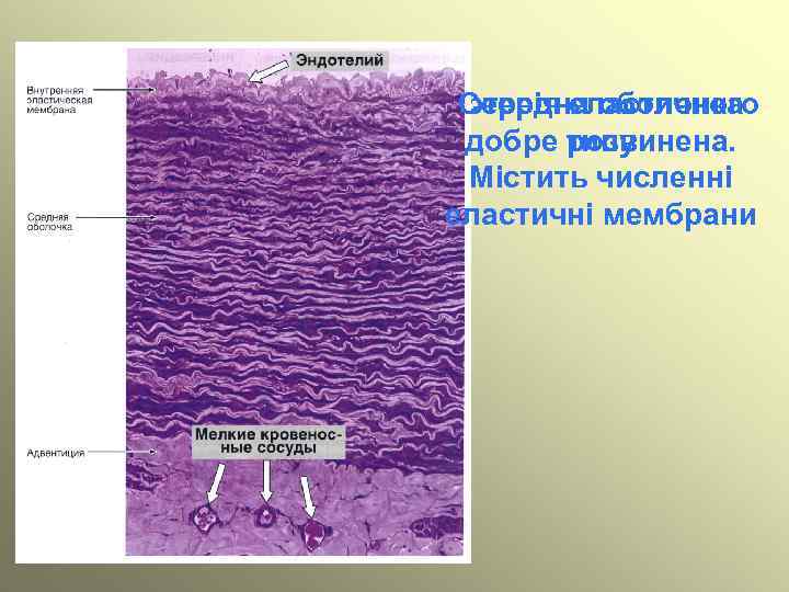 Середня оболонка Артерія еластичного добре типу розвинена. Містить численні еластичні мембрани 