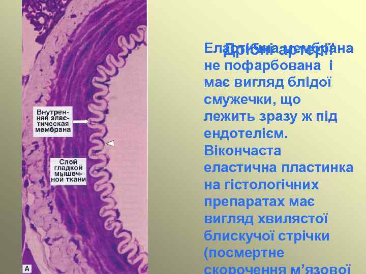 Еластичнаартерії Дрібні мембрана не пофарбована і має вигляд блідої смужечки, що лежить зразу ж