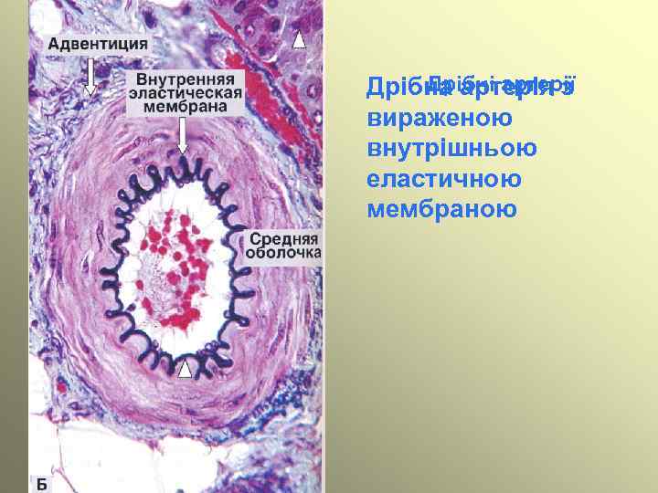 Дрібні артерії Дрібна артерія з вираженою внутрішньою еластичною мембраною 