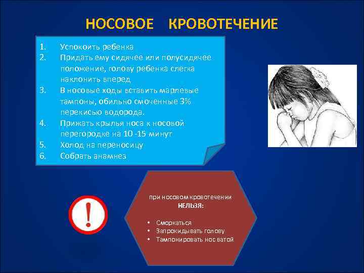 НОСОВОЕ КРОВОТЕЧЕНИЕ 1. 2. 3. 4. 5. 6. Успокоить ребенка Придать ему сидячее или