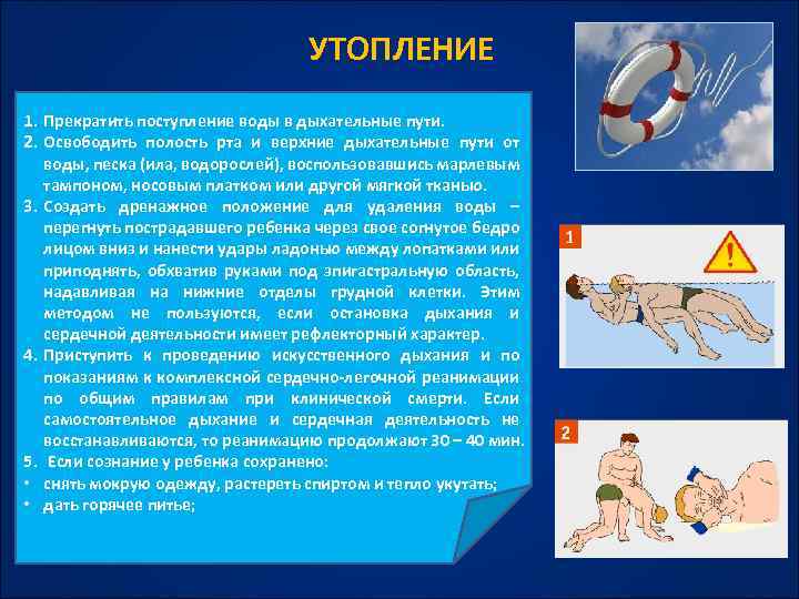 УТОПЛЕНИЕ 1. Прекратить поступление воды в дыхательные пути. 2. Освободить полость рта и верхние