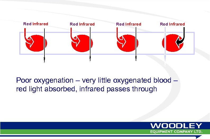 Red Infrared Poor oxygenation – very little oxygenated blood – red light absorbed, infrared