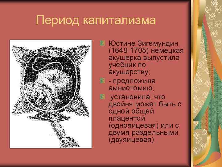 Период капитализма Юстине Зигемундин (1648 1705) немецкая акушерка выпустила учебник по акушерству; предложила амниотомию;
