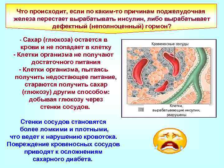 Что происходит, если по каким-то причинам поджелудочная железа перестает вырабатывать инсулин, либо вырабатывает дефектный