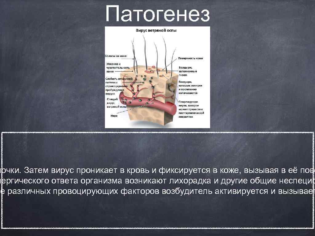 Анамнез ветряной оспы