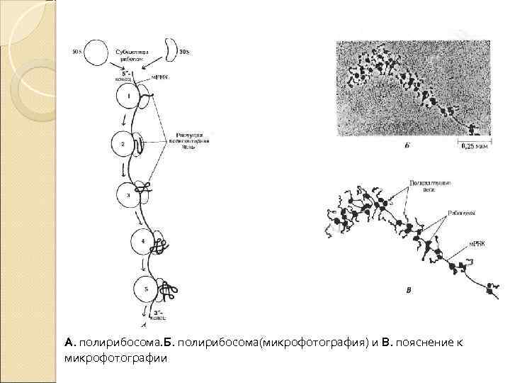 А. полирибосома. Б. полирибосома(микрофотография) и В. пояснение к микрофотографии 