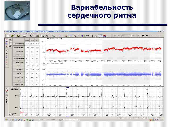 Вариабельность сердечного ритма