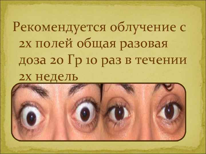 Рекомендуется облучение с 2 х полей общая разовая доза 20 Гр 10 раз в