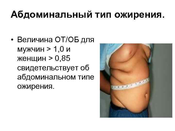 Абдоминальный тип ожирения у женщин фото
