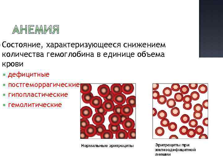 Анемии постгеморрагическая гемолитическая. Постгеморрагическая анемия картина крови. Постгеморрагическая анемия мазок. Острая постгеморрагическая анемия эритроциты. Постгеморрагическая анемия клиника.