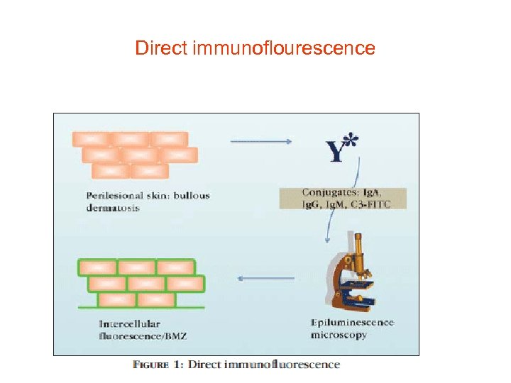 Direct immunoflourescence 