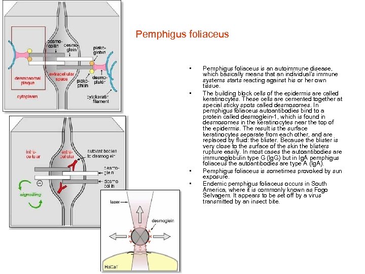 Pemphigus foliaceus • • Pemphigus foliaceus is an autoimmune disease, which basically means that