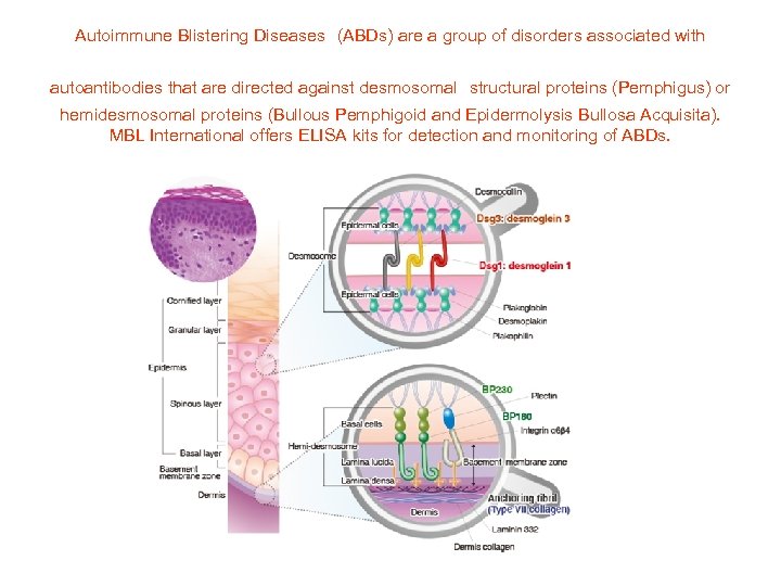  Autoimmune Blistering Diseases (ABDs) are a group of disorders associated with autoantibodies that