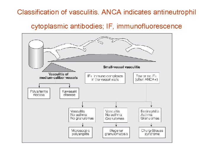 Classification of vasculitis. ANCA indicates antineutrophil cytoplasmic antibodies; IF, immunofluorescence 