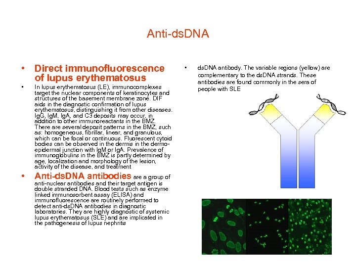 Anti-ds. DNA • Direct immunofluorescence of lupus erythematosus • In lupus erythematosus (LE), immunocomplexes