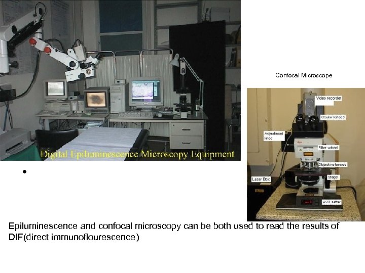  • Confocal Microscope • Epiluminescence and confocal microscopy can be both used to