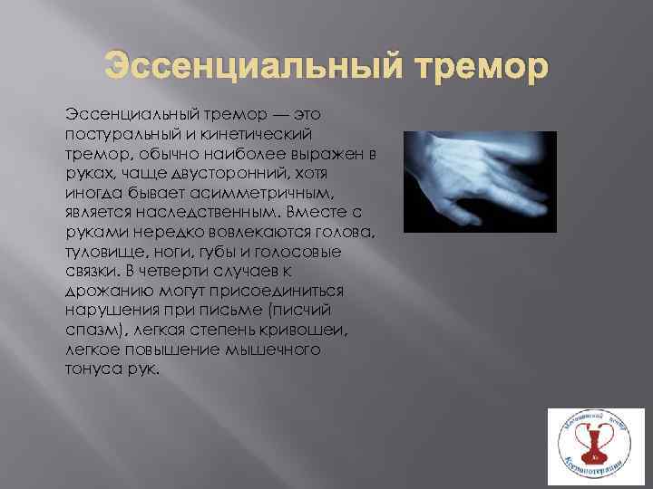 Эссенциальный тремор — это постуральный и кинетический тремор, обычно наиболее выражен в руках, чаще