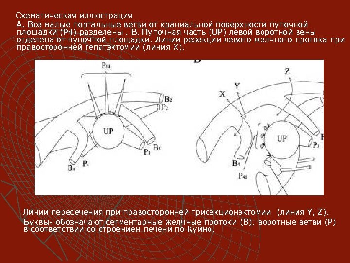 Схематическая иллюстрация А. Все малые портальные ветви от краниальной поверхности пупочной площадки (Р 4)