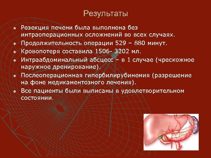 Результаты u u u Резекция печени была выполнена без интраоперационных осложнений во всех случаях.
