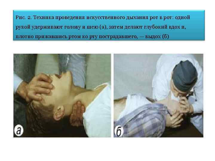 Рис. 2. Техника проведения искусственного дыхания рот в рот: одной рукой удерживают голову и