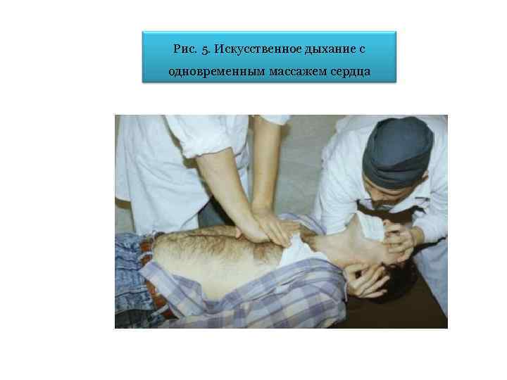 Рис. 5. Искусственное дыхание с одновременным массажем сердца 