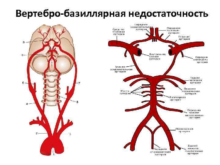 Вертебро-базиллярная недостаточность 