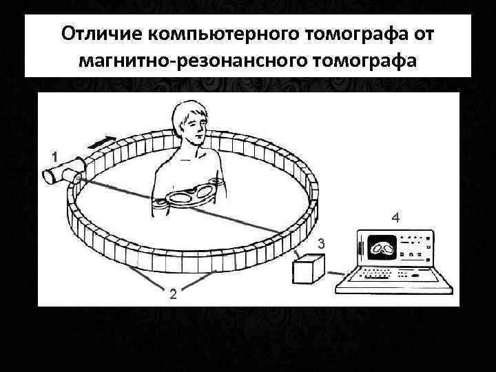 Отличие компьютерного томографа от магнитно-резонансного томографа 