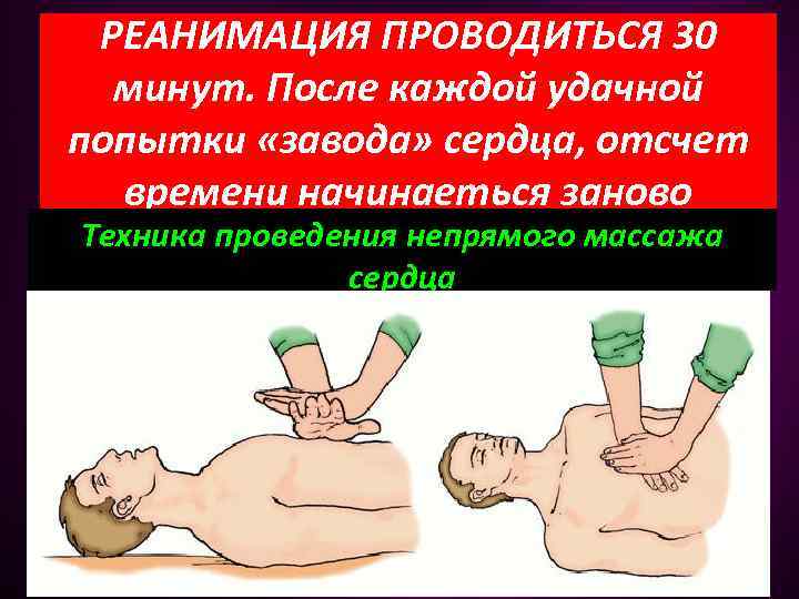 РЕАНИМАЦИЯ ПРОВОДИТЬСЯ 30 минут. После каждой удачной попытки «завода» сердца, отсчет времени начинаеться заново