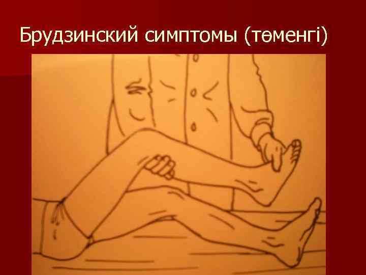 Брудзинский симптомы (төменгі) 