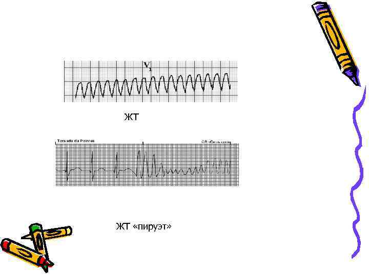 ЖТ ЖТ «пируэт» 