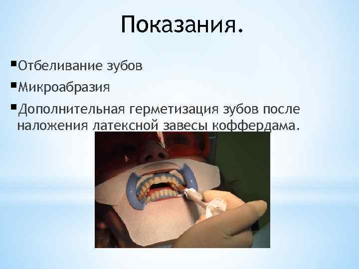 Показания. §Отбеливание зубов §Микроабразия §Дополнительная герметизация зубов после наложения латексной завесы коффердама. 