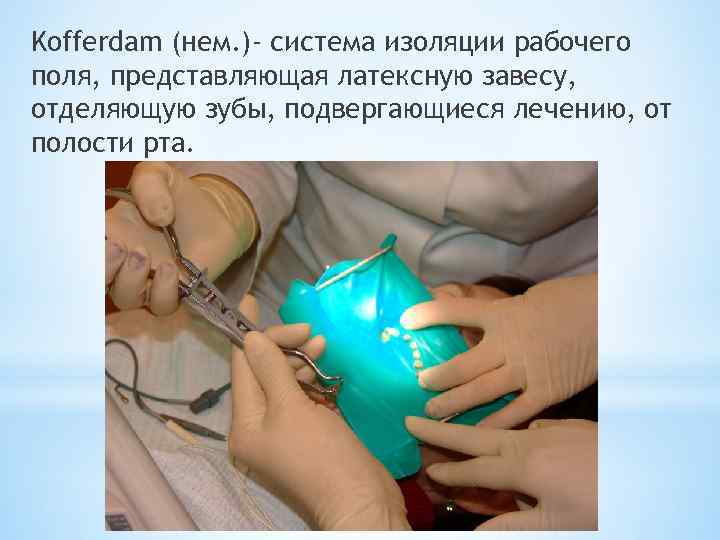 Kofferdam (нем. )- система изоляции рабочего поля, представляющая латексную завесу, отделяющую зубы, подвергающиеся лечению,